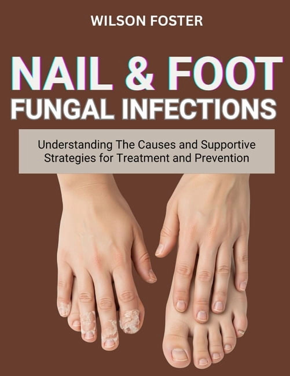 Nail & Foot Fungal Infections: Understanding The Causes And Supportive ...