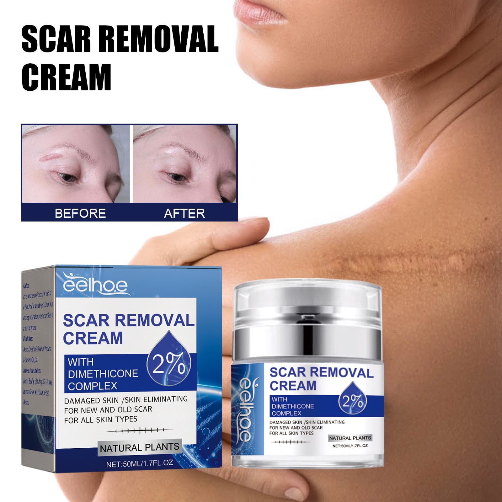 Narveanno Deals Scar Removal Cream Scar Repair Cream Scar Removal And