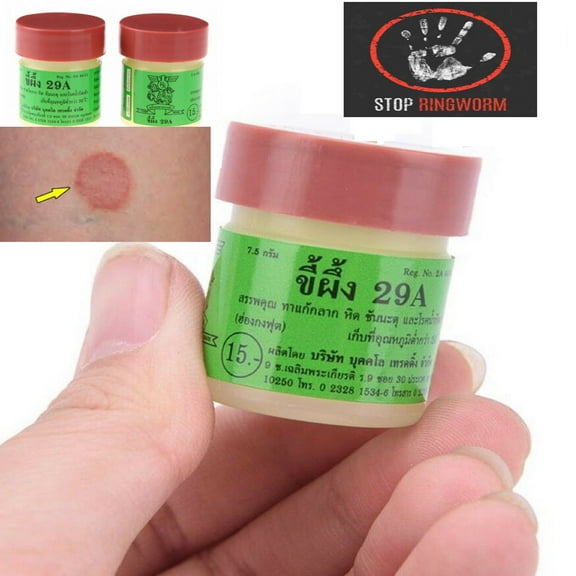 Jock Itch Treatments