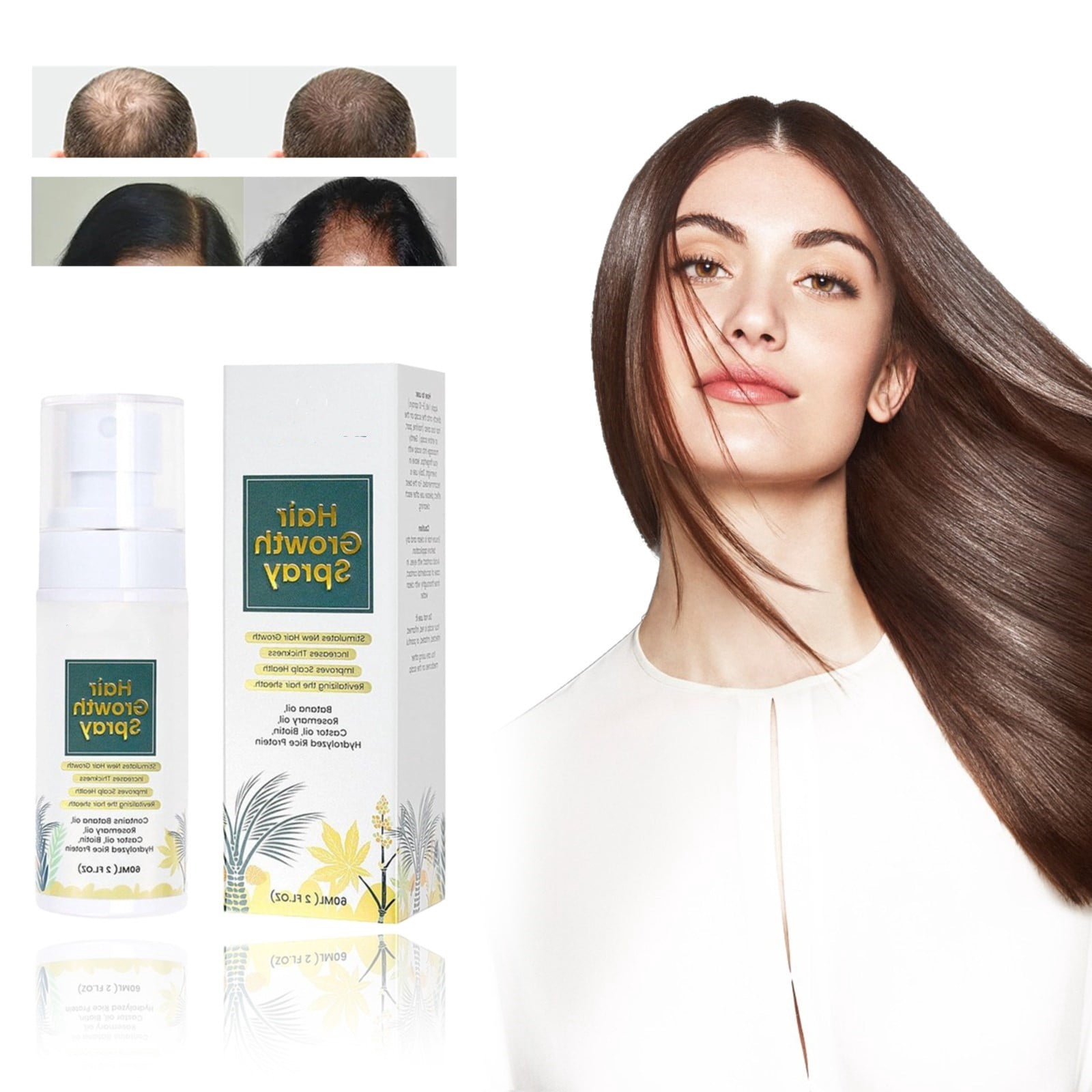 Natural Hair Growth Oil Spray Scalp Thinning Hair For Dense Women