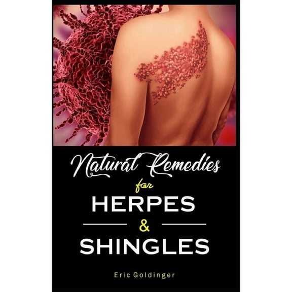 Natural Remedies For HERPES & SHINGLES: The Complete Guide, (Paperback)