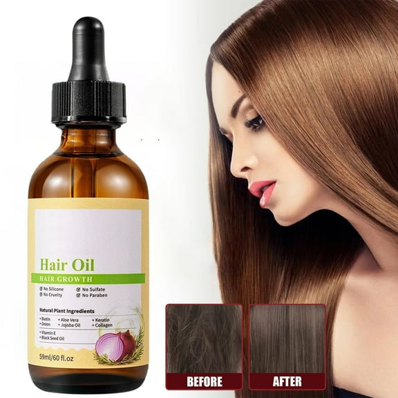 Natural Rosemary Oil, Botanical Scalp Oil with Herbal Infusion, Biotin Hair Serum for Men and Women, Intense Treatment Product with Natural Botanical Oil Blend to Help Boost Thin Hair, 2 Fl Oz