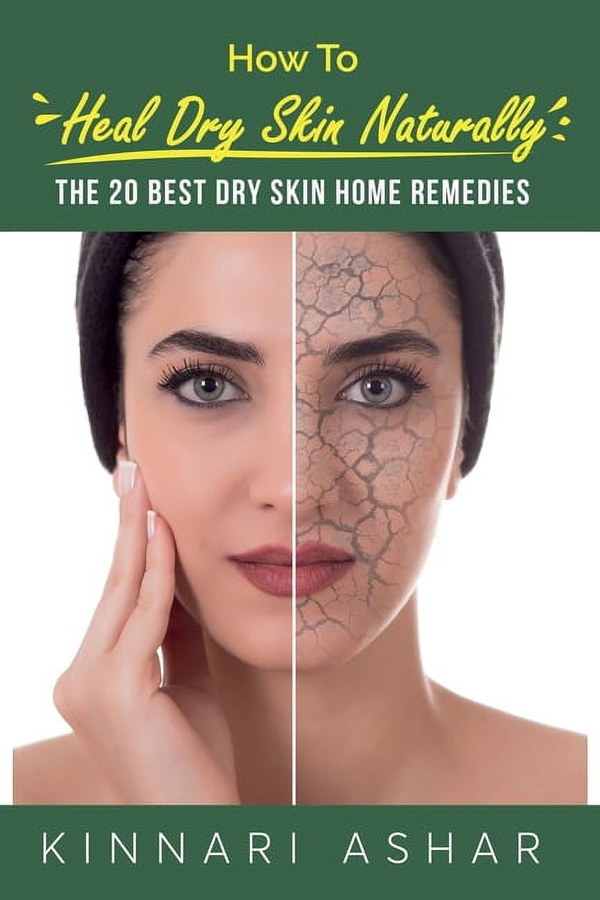 Natural Skin Care How to Heal Dry Skin Naturally The 20 Best Dry