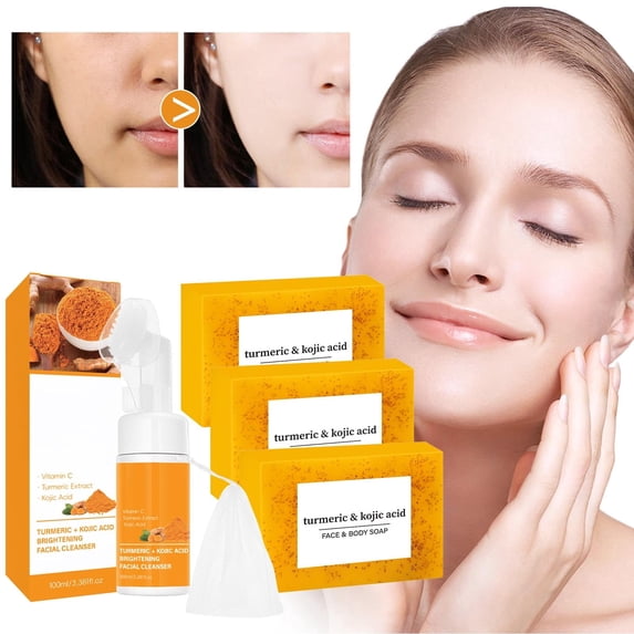3pcs Ginger Yellow Soap+Cleansing Mousse Set,Natural Usman Grass Solid Shampoo Soap,Plant-Based Hair Cleanser with Herbal Extracts,120g