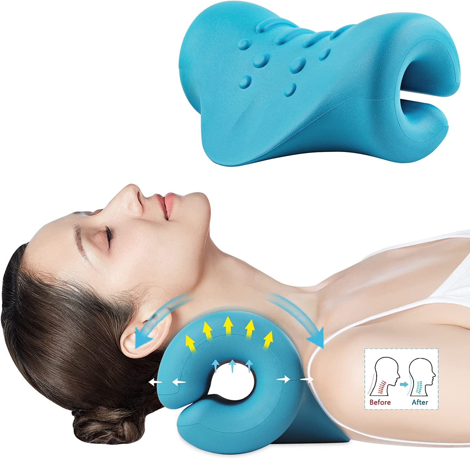 https://i5.walmartimages.com/seo/Neck-Shoulder-Relaxer-Portable-Cervical-Traction-Device-Stretcher-Neck-Posture-Corrector-Chiropractic-Pillow-TMJ-Pain-Relief-Spine-Alignment-Blue_9d41645e-fdf5-464d-aee6-aea9546ba9a2.6a8b43d4c88a71b709c4bc3065299164.jpeg