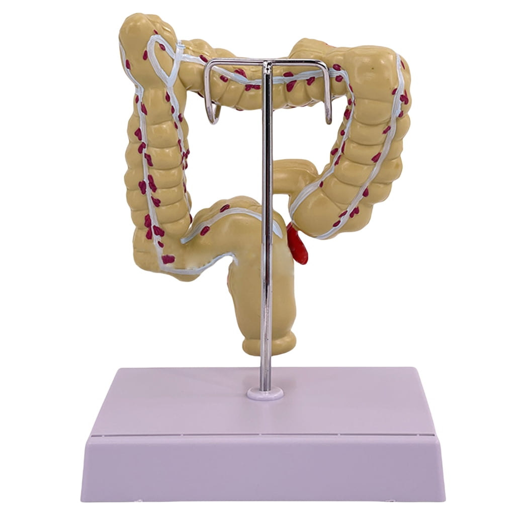 Necvior Large Intestine Pathologies Model Human Large Intestine Model ...