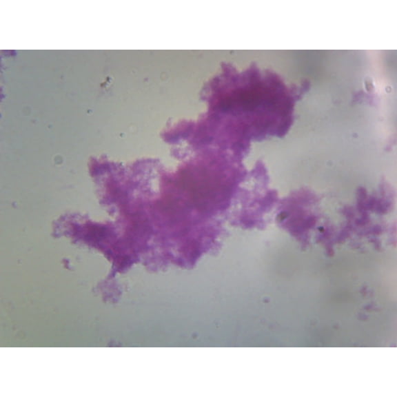 Neisseria Gonorrhoeae; Smear; Gram-Negative by Go Science Crazy