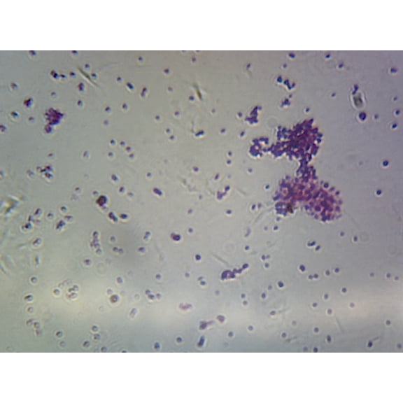 Neisseria (Gram-Negative) and Enterococcus (Gram-Positive); Smear by Go Science Crazy