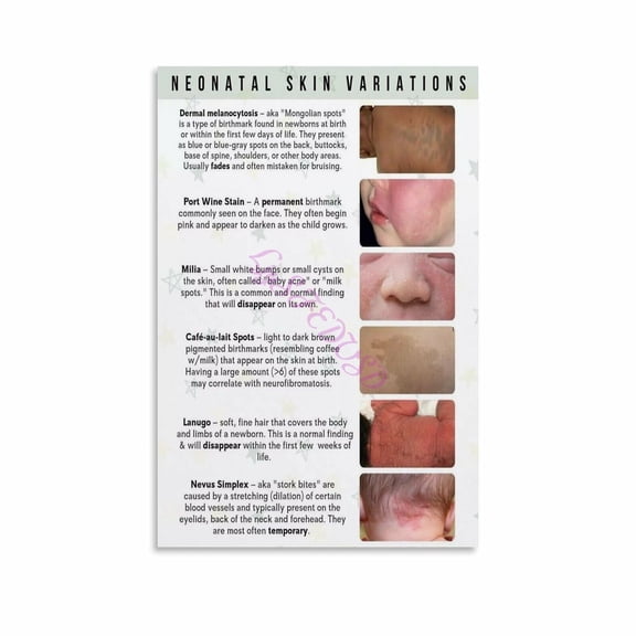 Neonatal Birthmark Skin Variations Infographic Pediatric Care Wall Poster Canvas Painting Wall Art