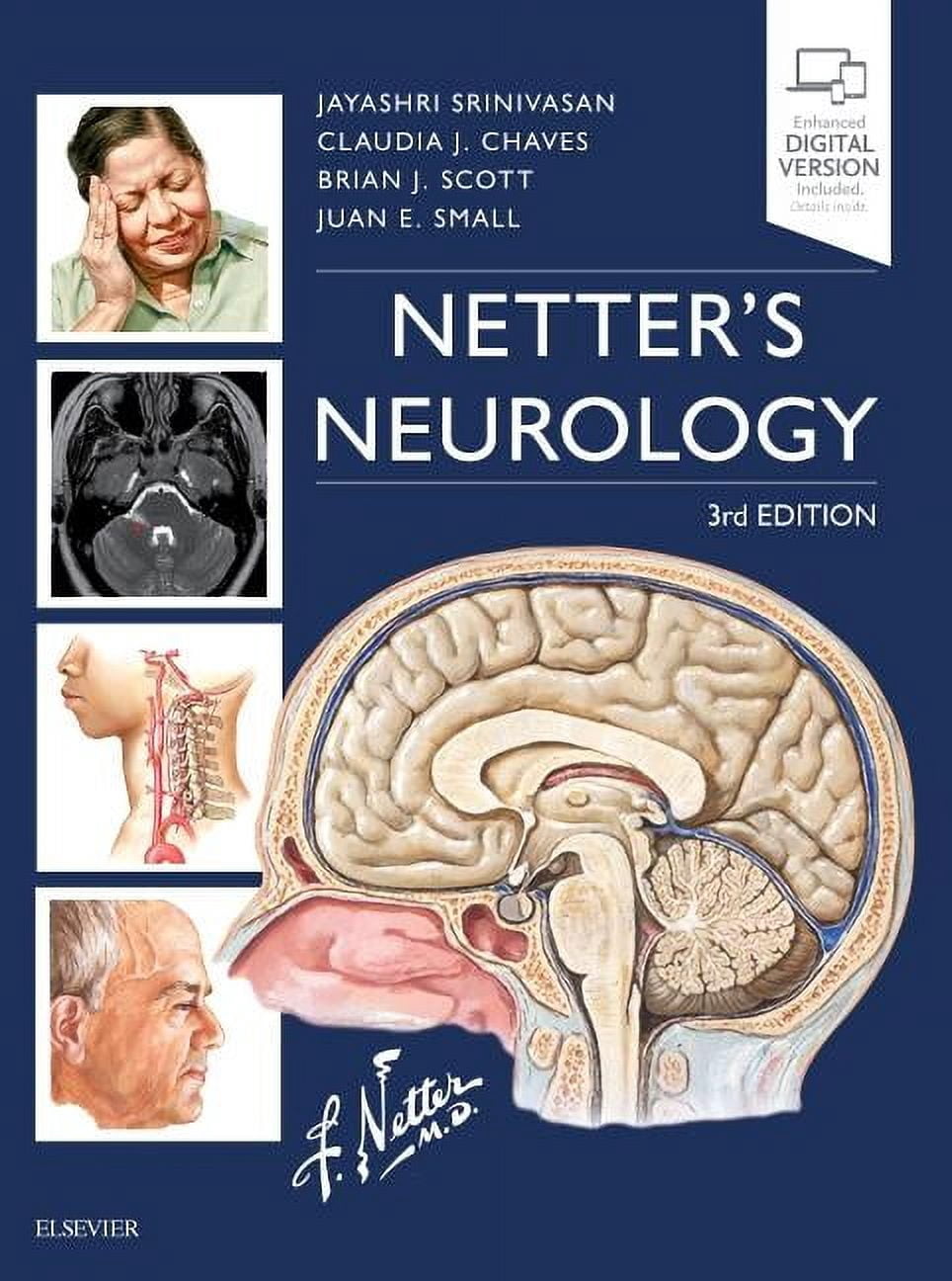 Netter Clinical Science Netter's Neurology, (Hardcover) - Walmart ...