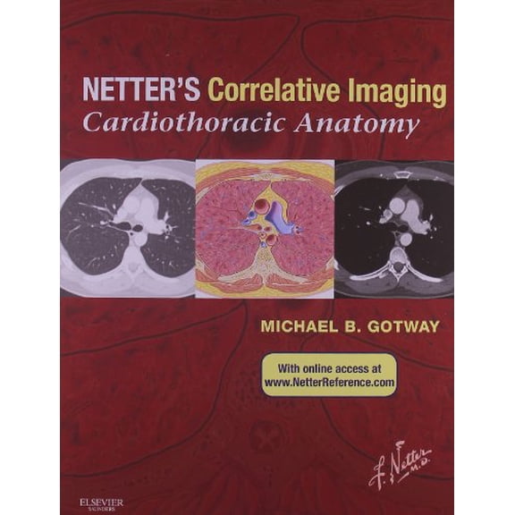 Pre-Owned Netter?s Correlative Imaging: Cardiothoracic Anatomy [Hardcover] Gotway, Michael B., M.D.; Netter, Frank H., M.D.; Marzejon, Kristen Wienandt and Machado, Carlos A. G., M.D.