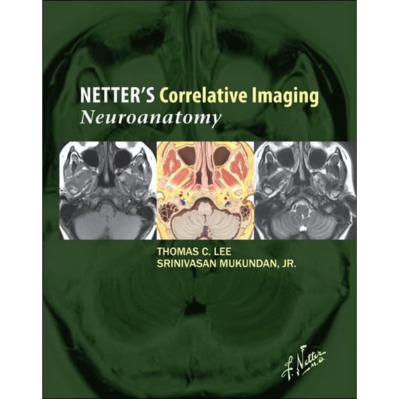 Netter Clinical Science Netter's Correlative Imaging: Neuroanatomy with Access Code, (Hardcover)