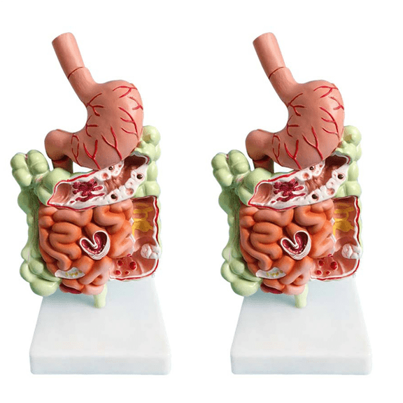 New Arrivals 2X Human Digestive System Model Stomach Anatomy Large Intestine Cecum Rectum Duodenum Internal Organs