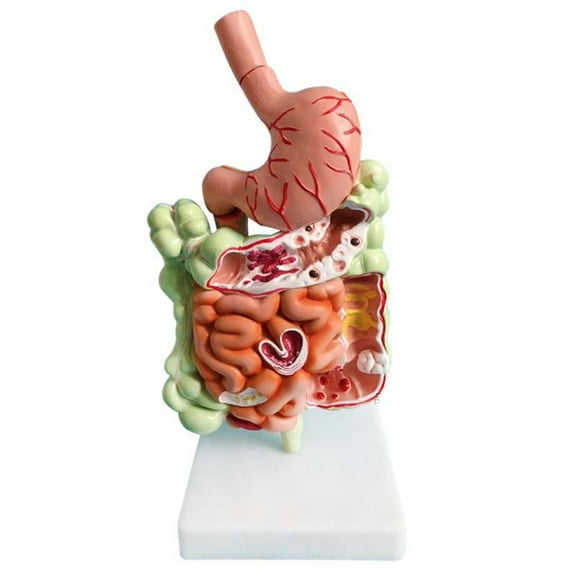 New Arrivals Human Digestive System Model Stomach Anatomy Large Intestine Cecum Rectum Duodenum Internal Organs Structure