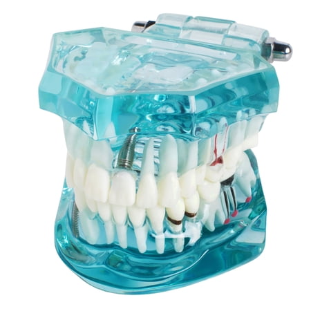 New Dental Study Tooth Transparent Adult Pathological Teeth Model