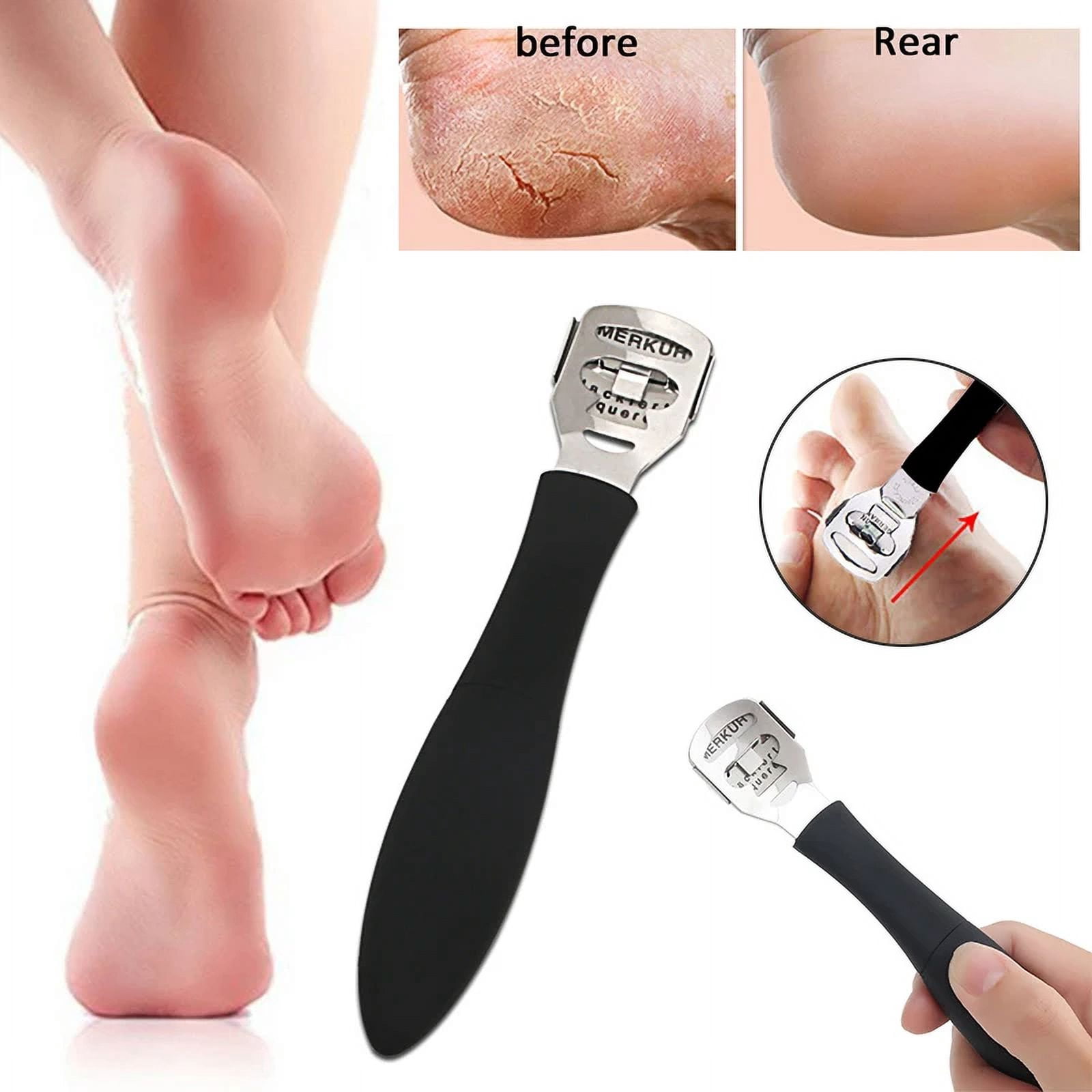 New Foot Calluses Remover Rasp File Callus Corn Cuticle Cutter Remover ...