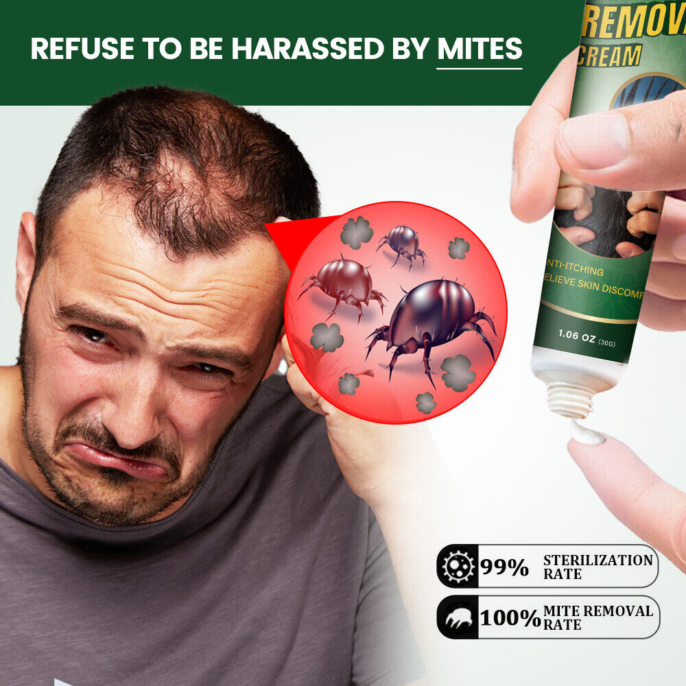 New Mite Removal Ointment AntiItching Scabies Kill Head Lice Skin Care