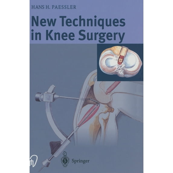New Techniques in Knee Surgery (Hardcover)