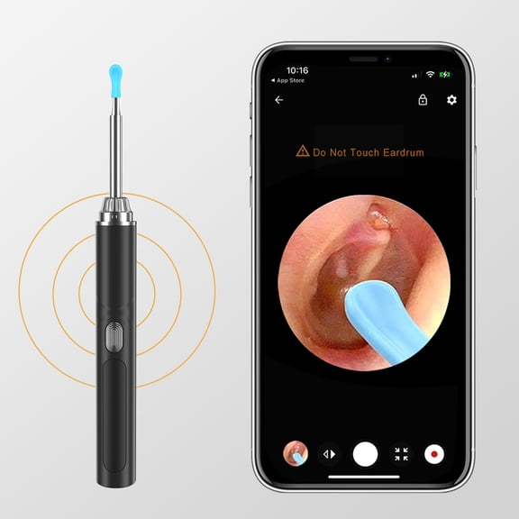 Ni-SHEN Ear Wax Removal Kit with 1080P HD Camera - Ear Cleaner Tool for iPhone & Android, Safe Earwax Remover with Light, 5 Ear Spoon,9-piece set of tools, one click direct connection