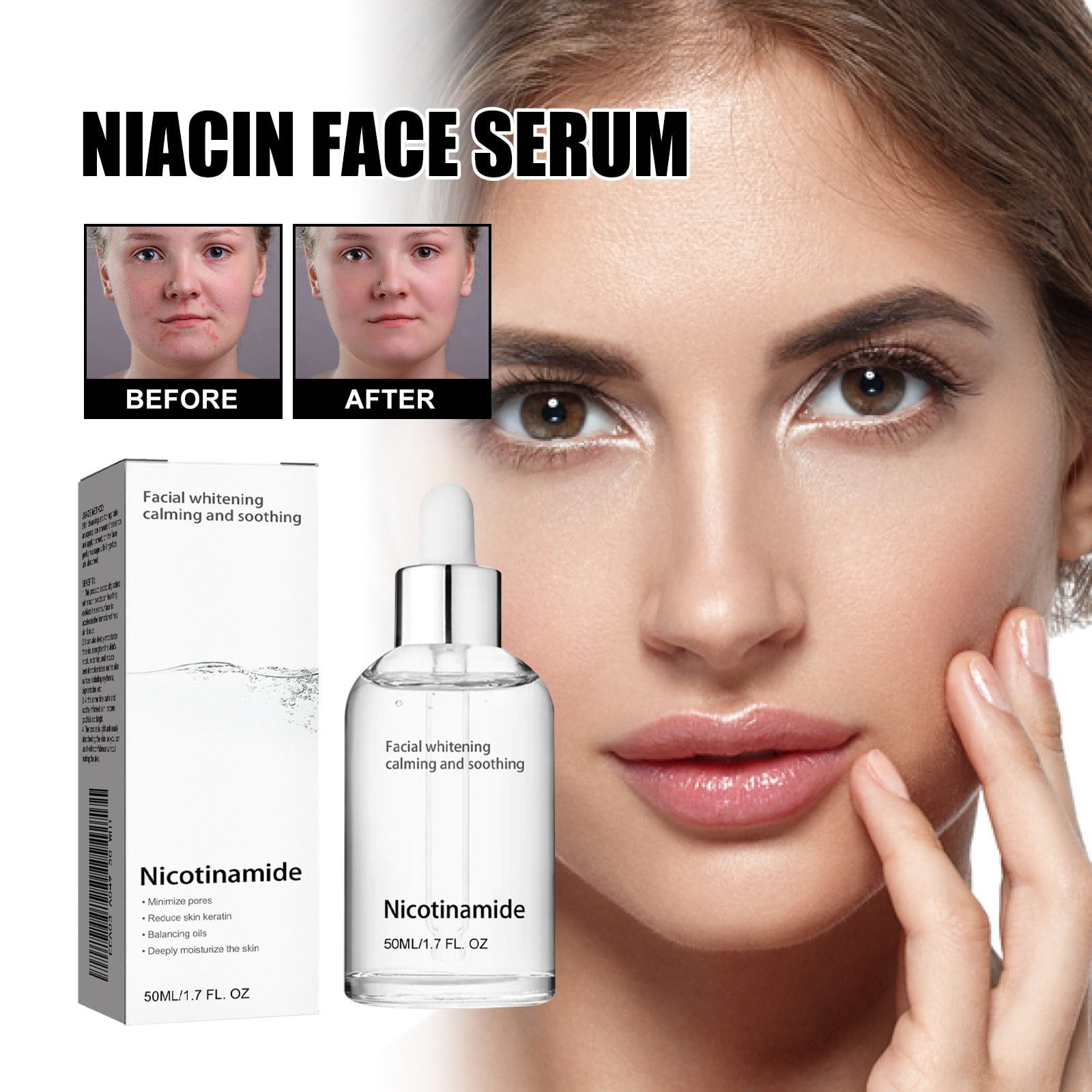 Niacin Facial Fades Marks Moisturizes Shrinks Pores Skin And Beautifies