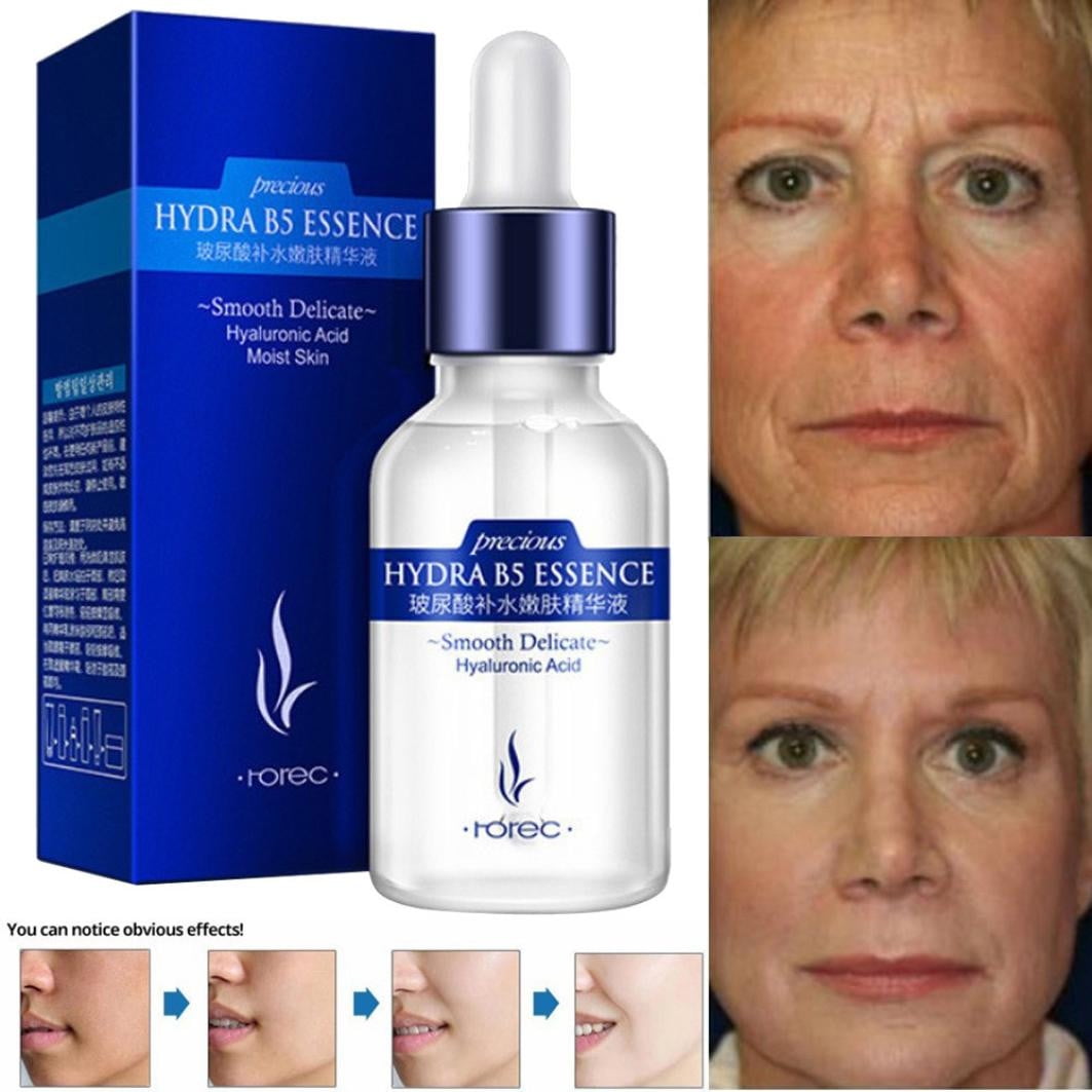 Niacinamide Spots Removal Serum, Extract Hydrates Hydrates Face To The