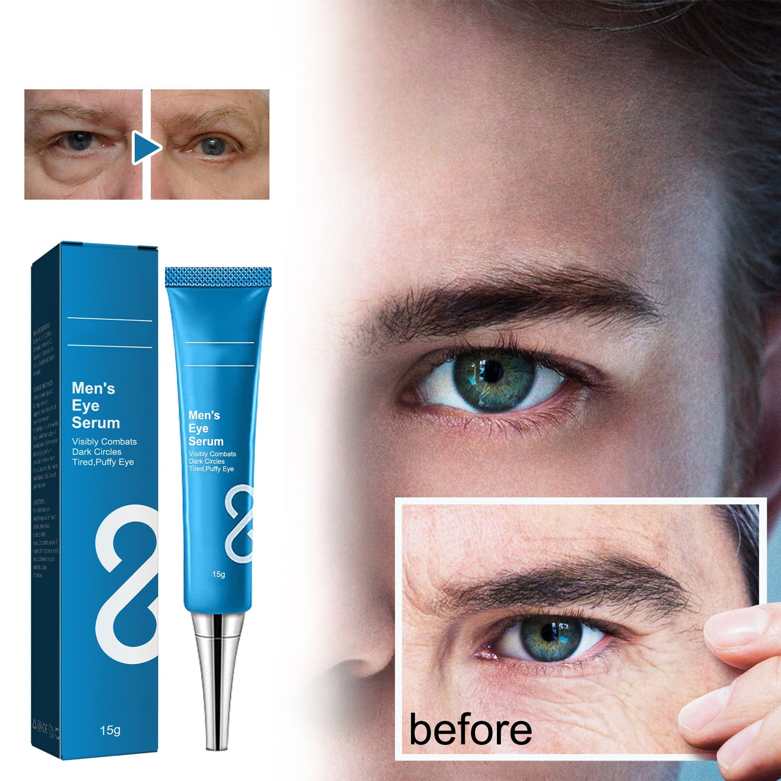 Niacinamide Spots Removal Serum, Men'S Eye Care Fine Lines under The
