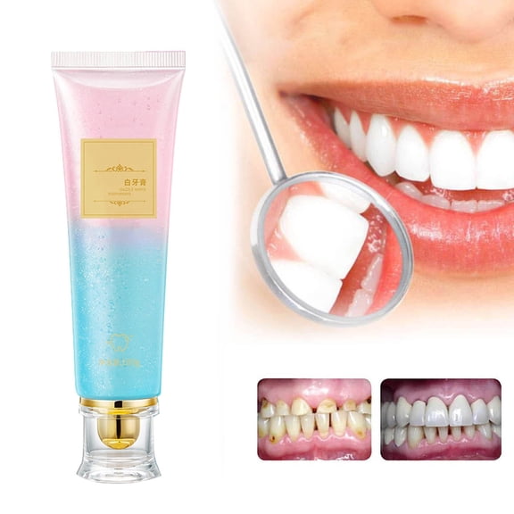 Niacinamide Whitening Toothpaste, Niacinamide Intensive Whiten-ing Toothpaste, Triple Whitening Niacinamides Intensive Toothpastes, Gentle Mint, Fresh Breath, Remove Tooth Stains