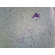 Nitrogen Fixing Bacteria Azotobacter and Rhizobium Leguminosarum; Smear; Gram-Negative by Go Science Crazy