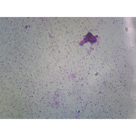 Gram Negative Rod Shaped Bacteria