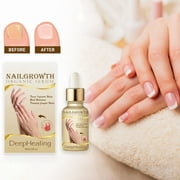 Niviya Nail Care Nail Care Liquid Repairing Hand Foot Nail Toe Grey Nail Shining Nail Lotion 30ml