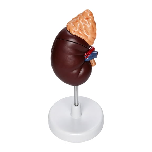 Nnndbs Life Size Human Kidney Anatomy Model 2 Parts, Normal and Pathological Kidney Structure Model for Medical Teaching, Doctor Office Educational Tool`