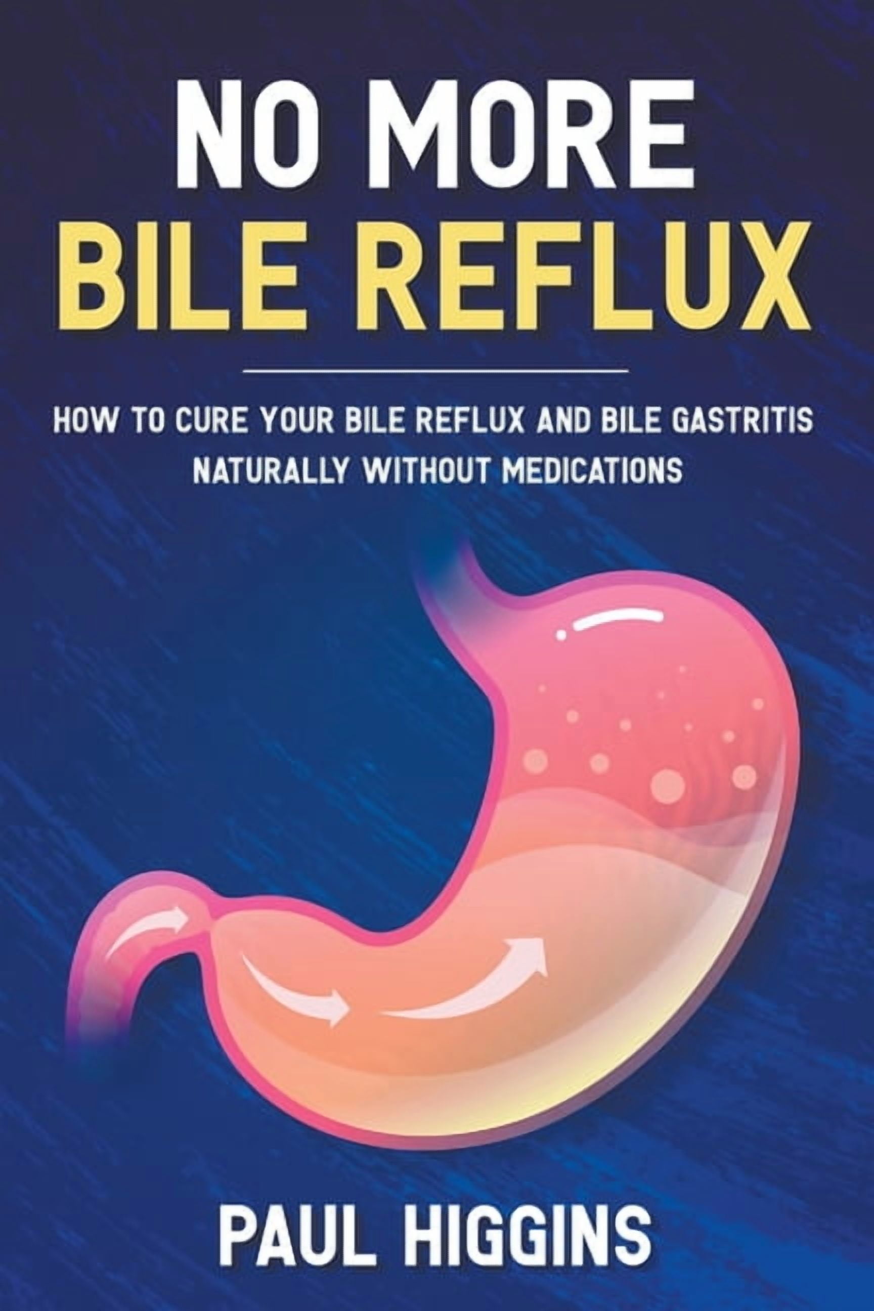 No More Bile Reflux (Paperback)