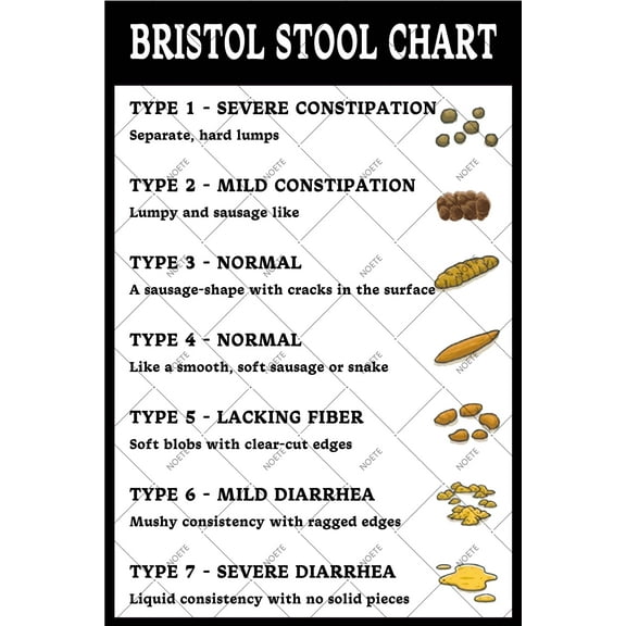 Noete 8x12 Inch Poop Color Chart Metal Tin Sign Retro Bathroom Wall Decor for Nurses, Doctors & Medical Students Funny Toilet Health Poster for Indoor & Outdoor Use
