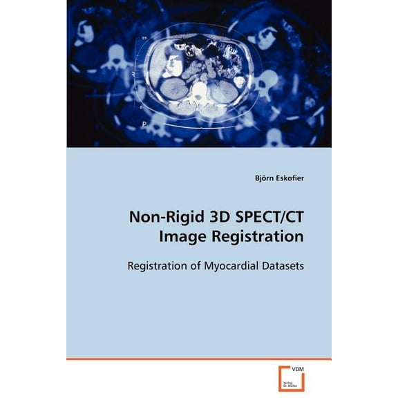 Non-Rigid 3D SPECT/CT Image Registration (Paperback)