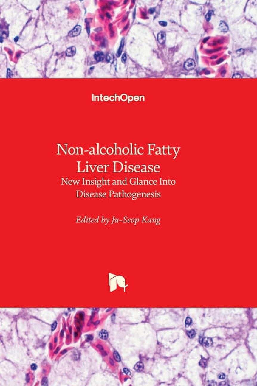 Non-alcoholic Fatty Liver Disease - New Insight and Glance Into Disease ...