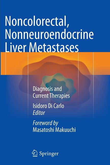 Noncolorectal, Nonneuroendocrine Liver Metastases: Diagnosis and Current Therapies (Paperback)