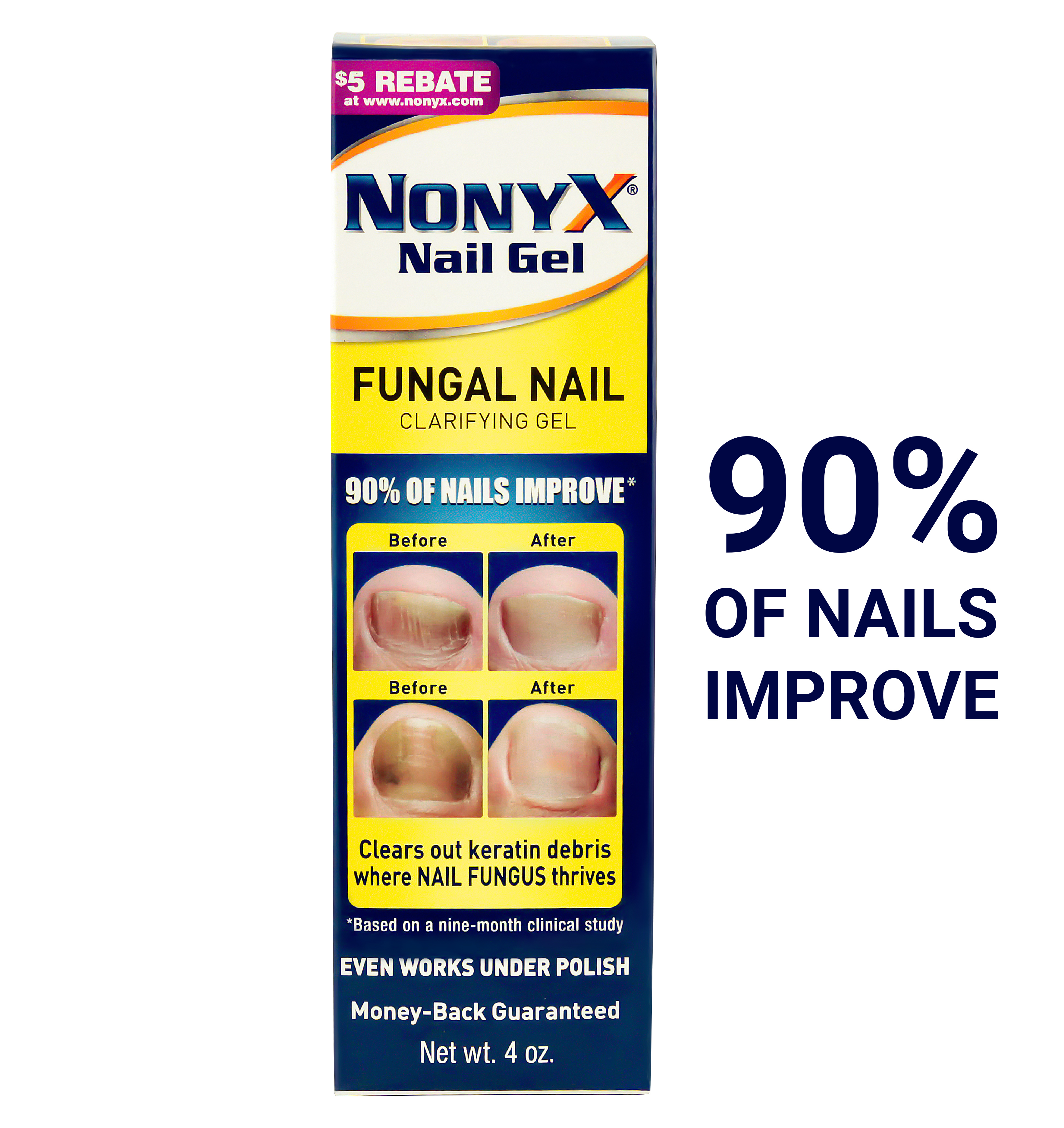Nonyx Fungal Nail Clarifying Gel | Clinically Proven Effective for Fungus Damaged Toenails | Results are Money-back Guaranteed, 4 oz. - image 1 of 9