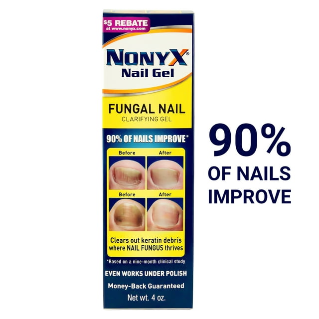 Nonyx Fungal Nail Clarifying Gel | Clinically Proven Effective for Fungus Damaged Toenails | Results are Money-back Guaranteed, 4 oz.