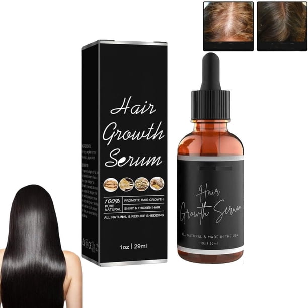 Noor Hair Growth Serum African Olives, Noor Love Hair Serum, Anti Hair