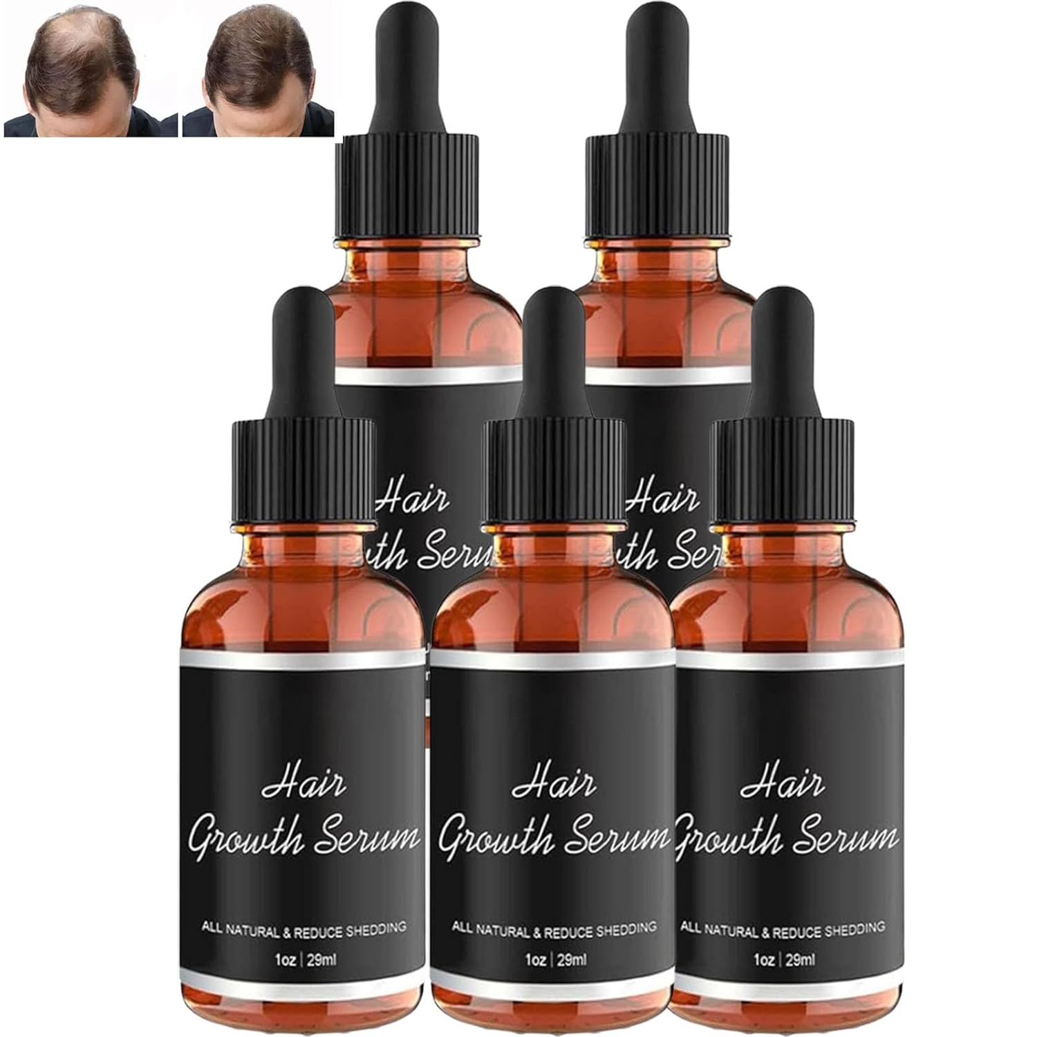 Noor Love Hair Serum Noor Hair Growth Serum African Olives, Hair