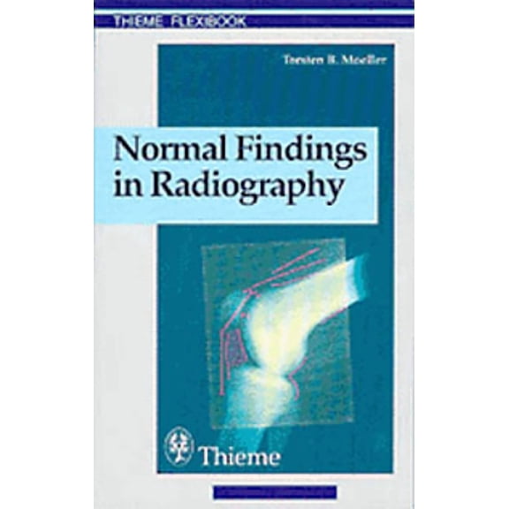 Normal Findings in Radiography, (Paperback)