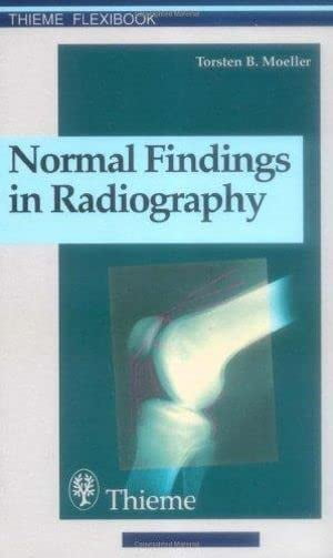 Pre-Owned Normal Findings in Radiography (Paperback) 3131165316 9783131165312
