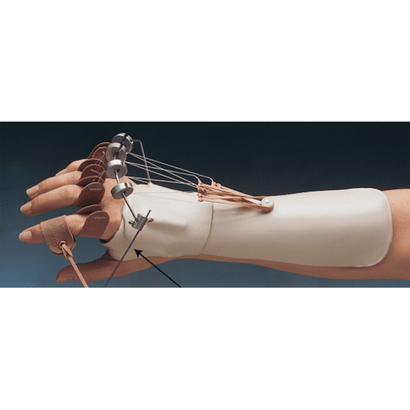 North Coast Medical Phoenix Outrigger Kits, Kit