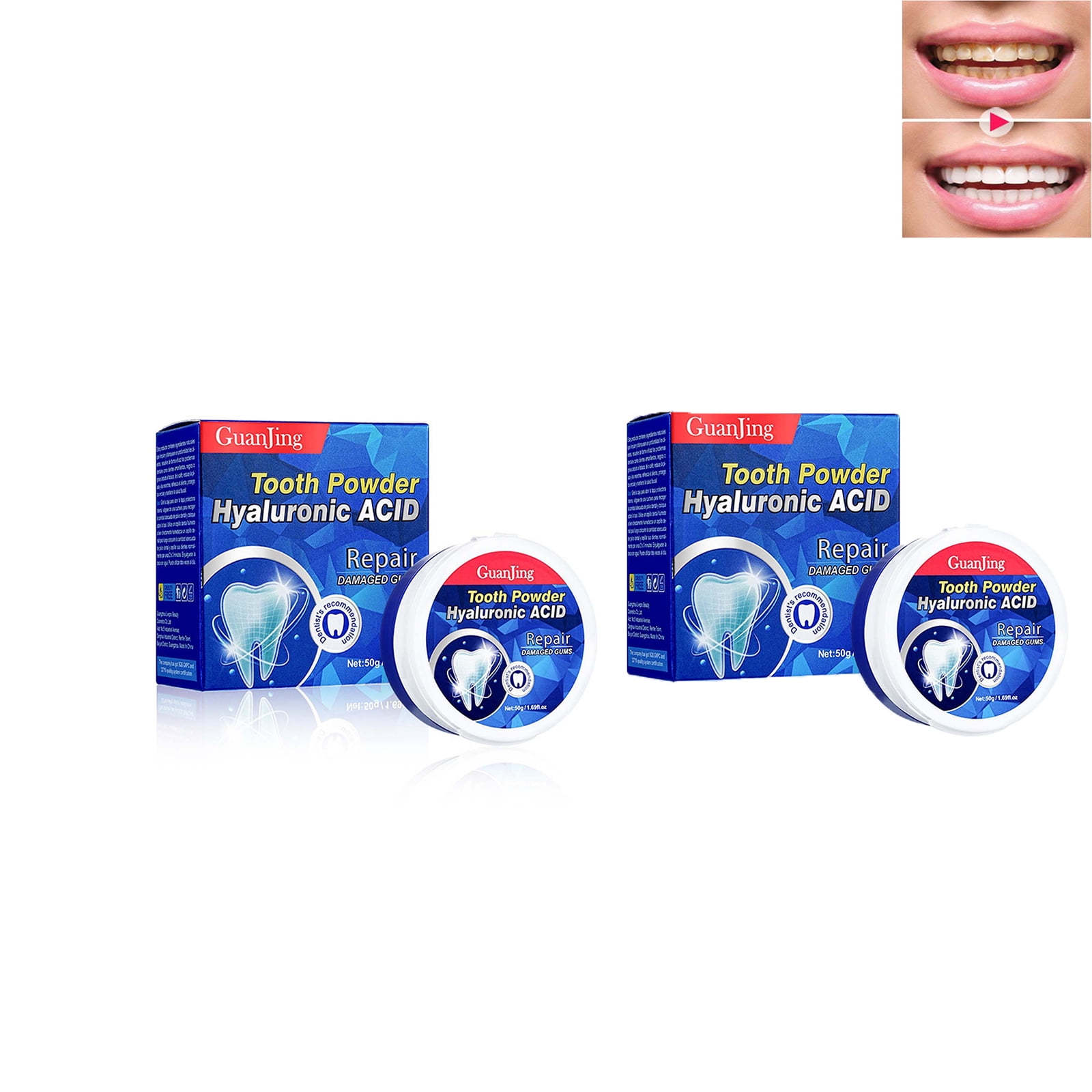 NuoWeiTong 2PC Parodontax Toothpaste,Stainremoving Improves Yellow