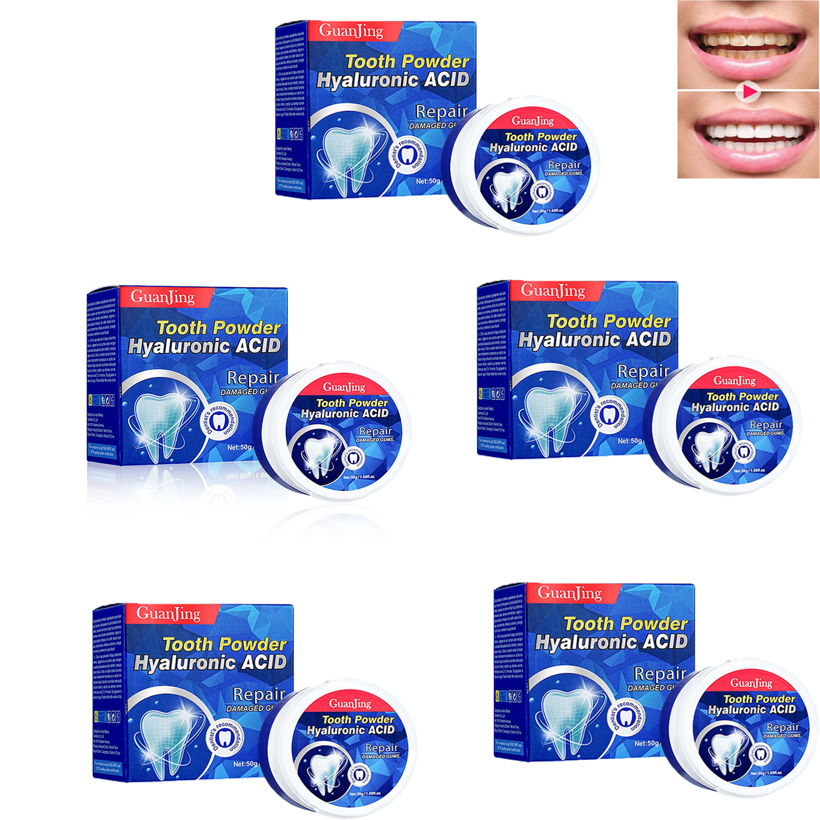 NuoWeiTong 5PC Parodontax Toothpaste,Stainremoving Improves Yellow