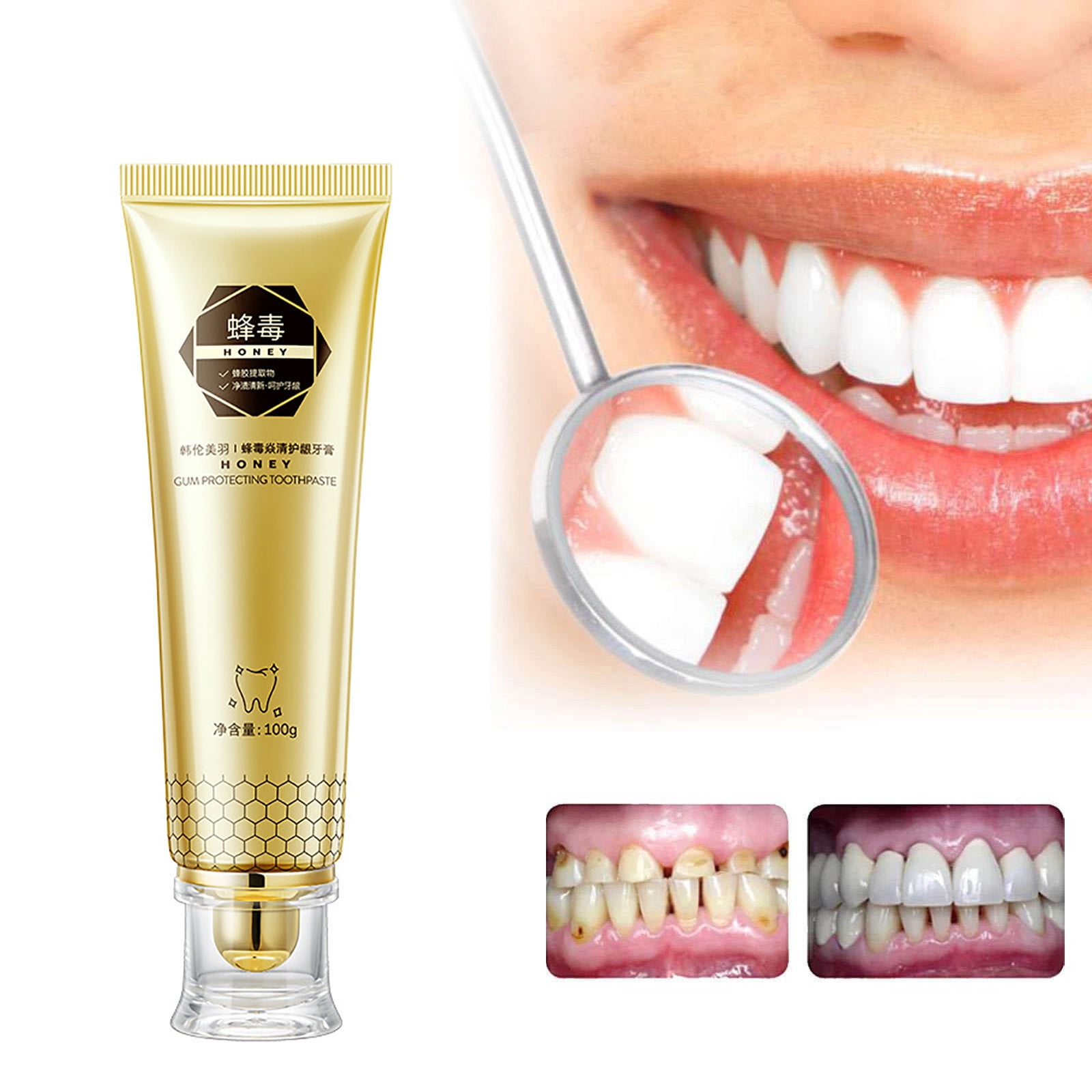 NuoWeiTong Parodontax Toothpaste,Bee Yan Qing Protection Toothpaste To