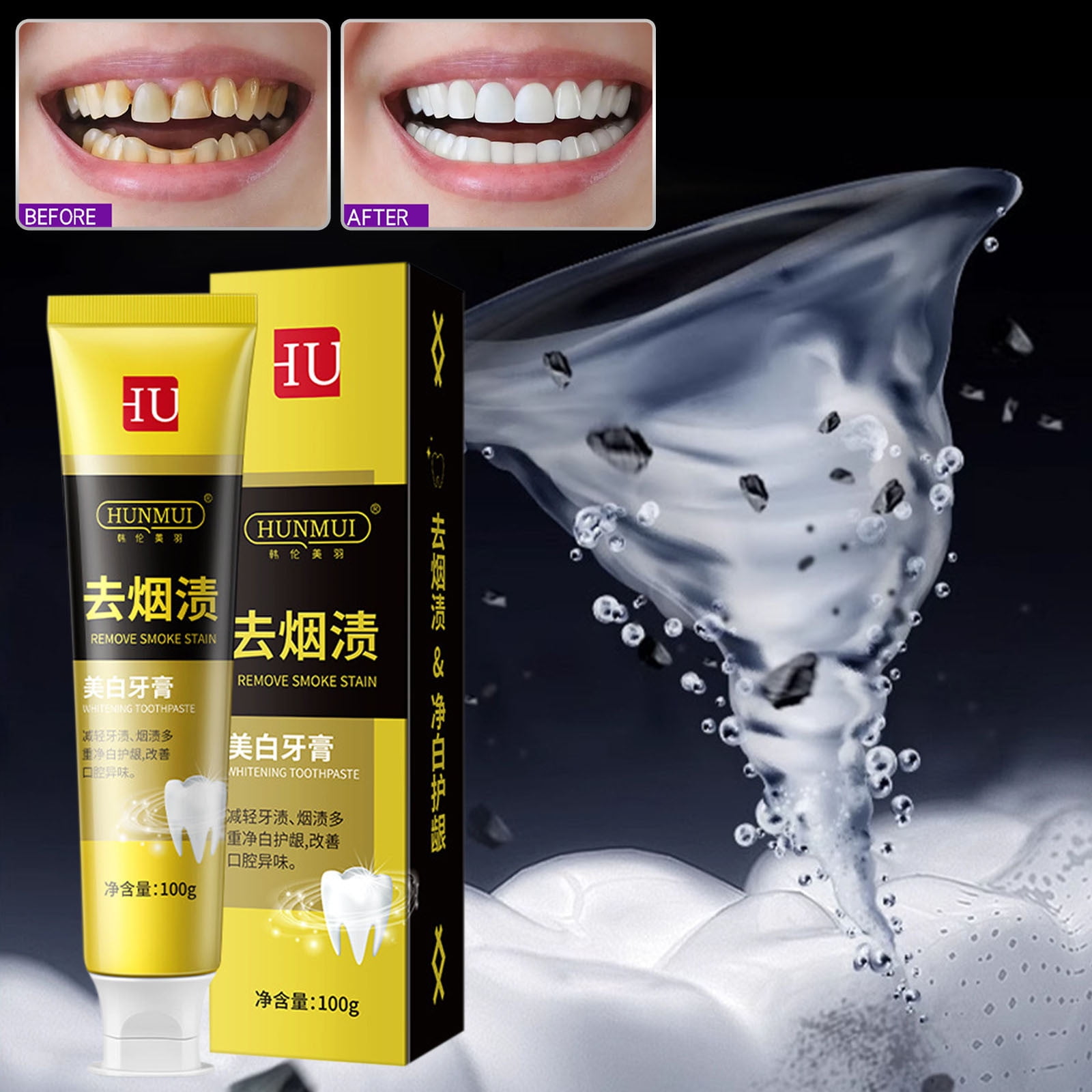 NuoWeiTong Parodontax Toothpaste,Removes Smokestains White Teeth