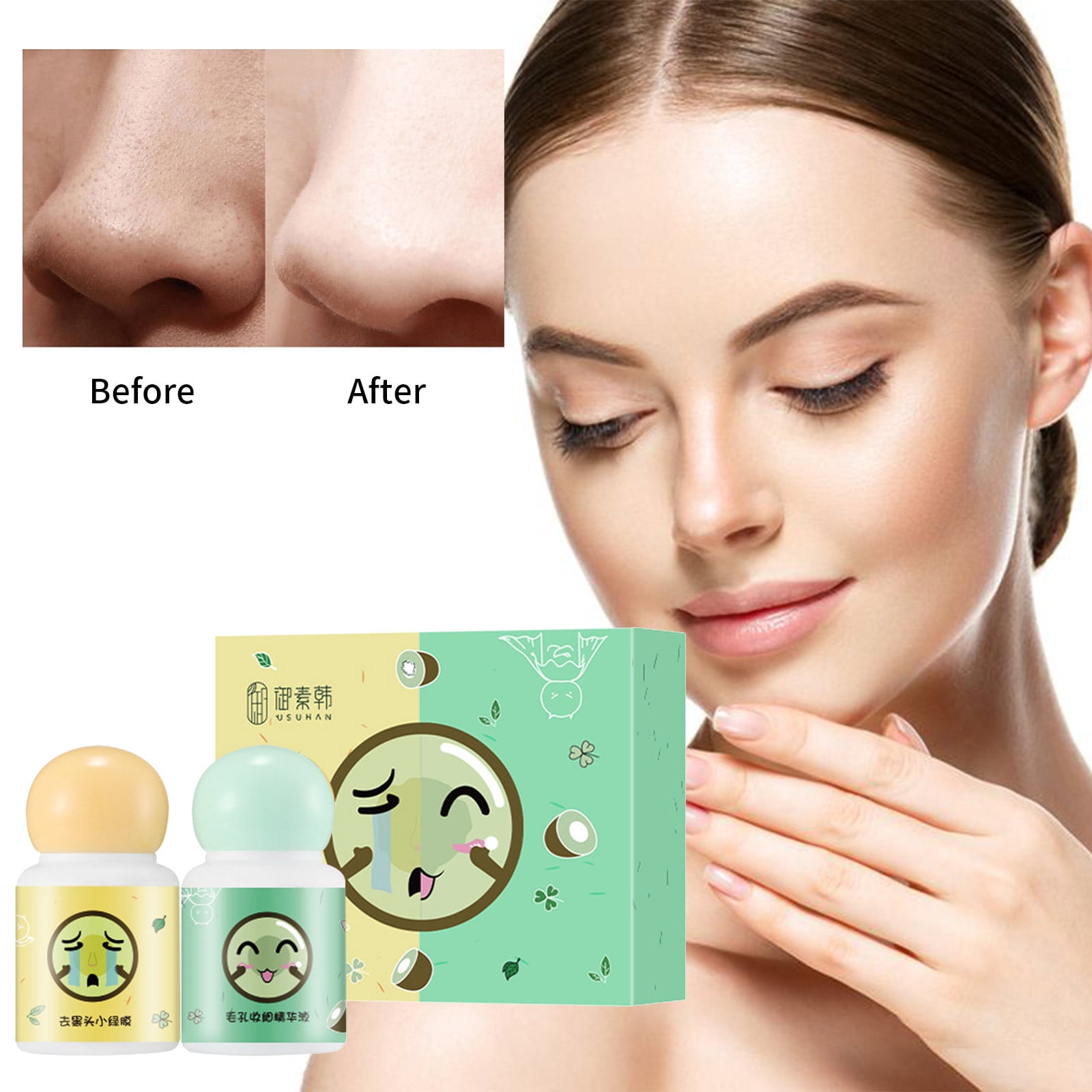 NuoWeiTong Remove Blackheads From Face,Small Suit To Blackheads Tear ...