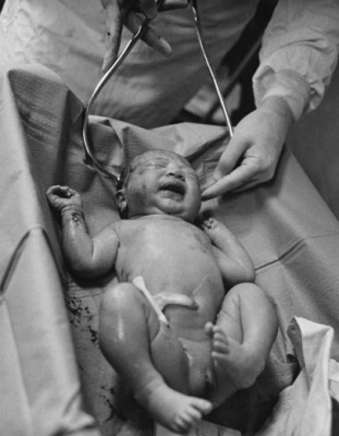 Nurse measuring a newborn babys head Canvas Art - (24 x 36)