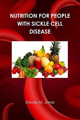 Pre-Owned Nutrition for people with Sickle Cell Disease Paperback ...